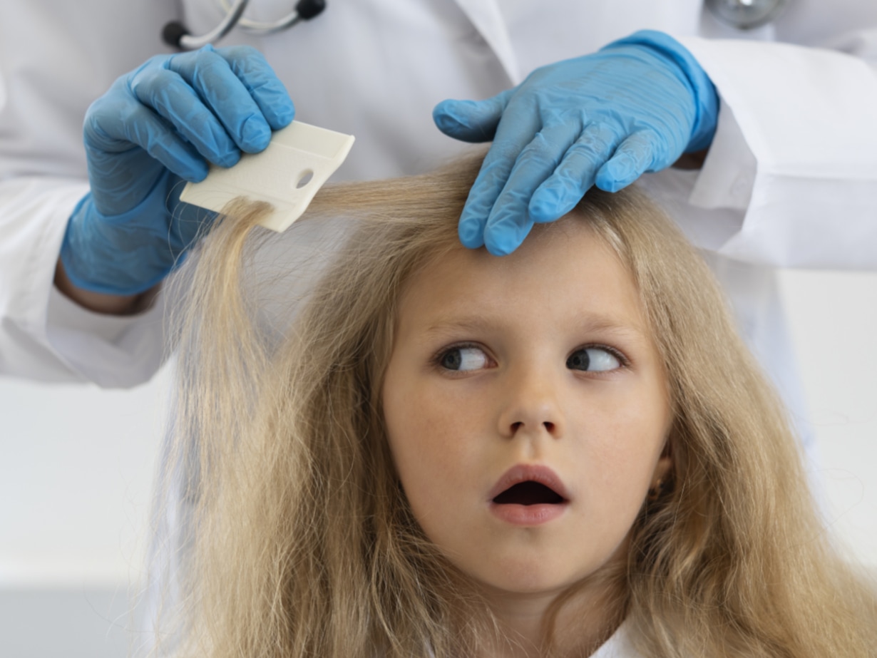 Médecin effectuant un examen des cheveux d'une enfant pour détecter la présence de poux.