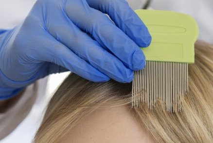 Utilisation d'un peigne à poux par un professionnel pour examiner les cheveux d'un patient.